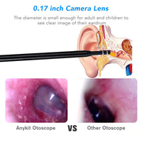 Ear Cleaning Endoscope - Komickonn